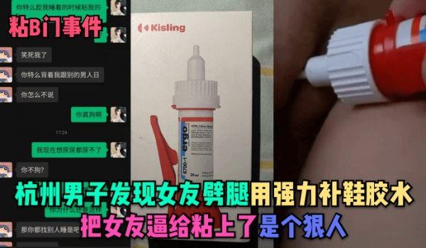 粘B门事件杭州男子发现女友噼腿 用强力补鞋胶水把女友逼给粘上了!是个狠人